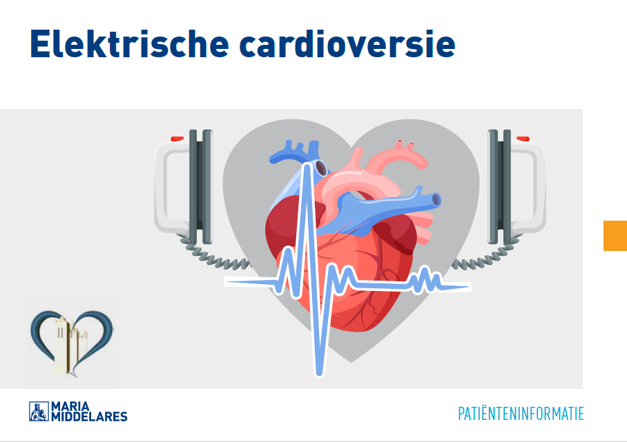 Elektrische Cardioversie | AZ Maria Middelares